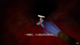 肠道检查