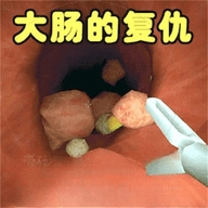 肠道检查